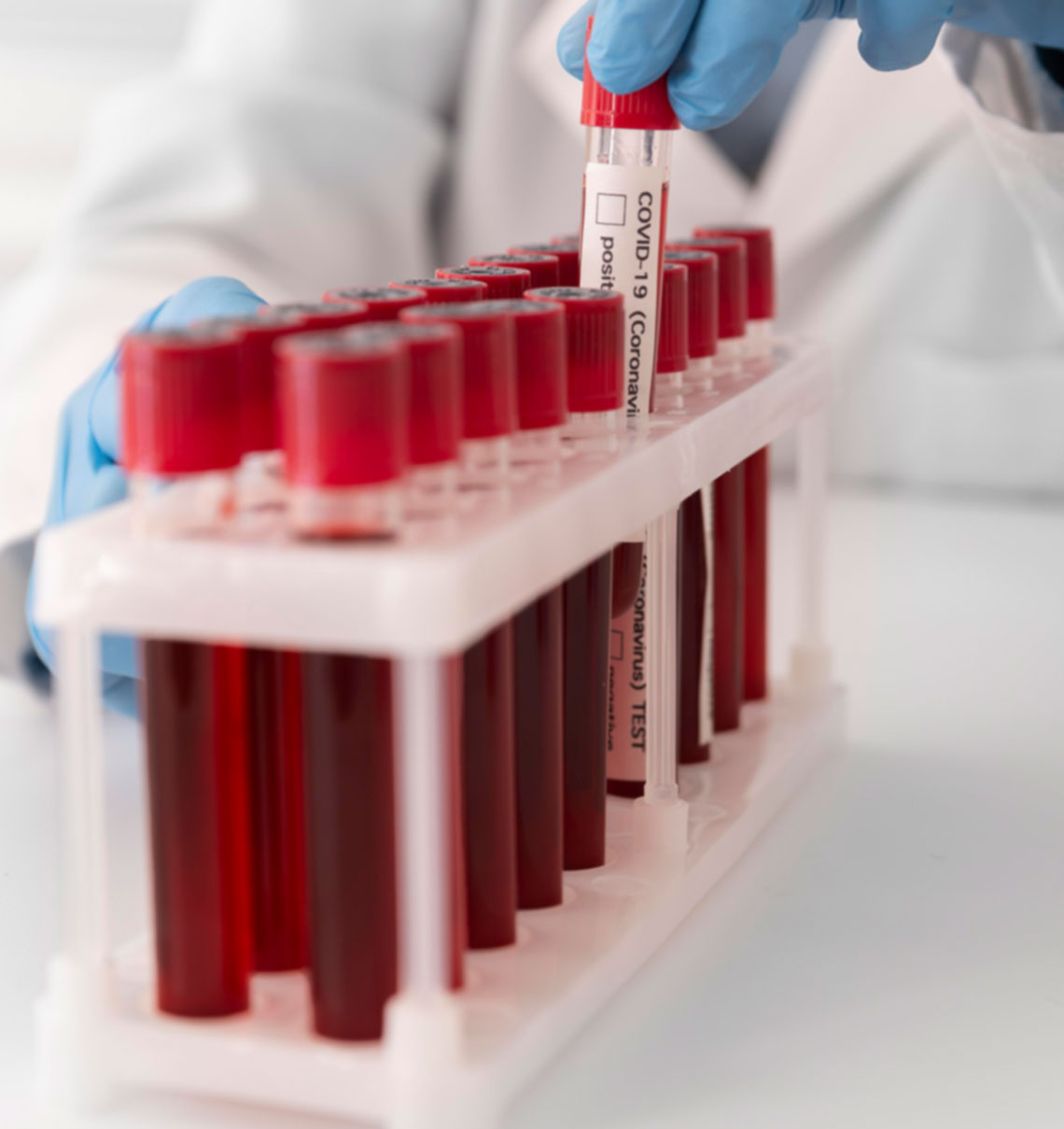 Transporte Médico Hospitalar